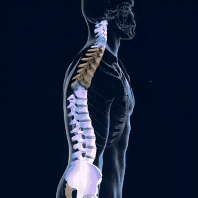 Backymate™- Original Back Hero Posture Corrector