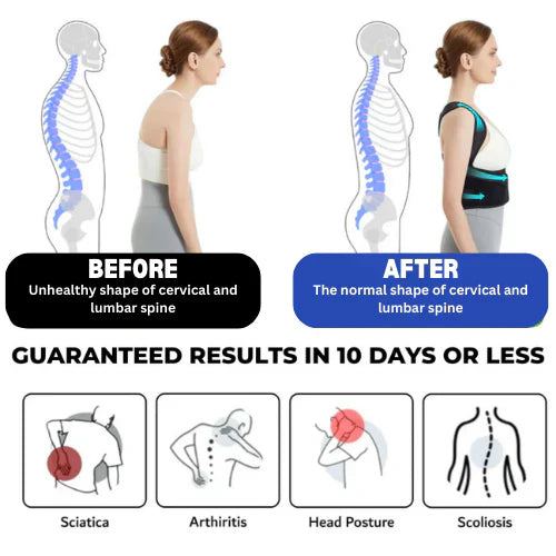 Backymate™- Original Back Hero Posture Corrector